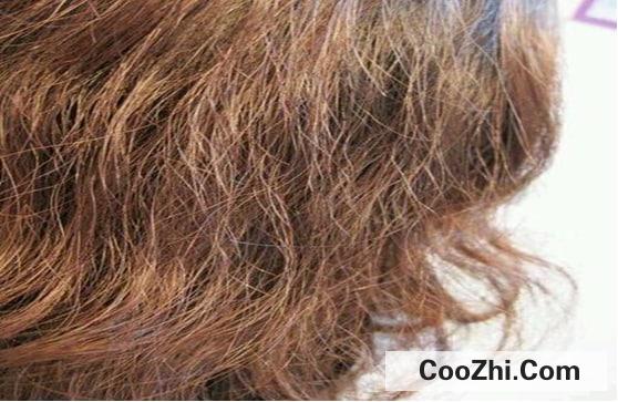 头皮油发尾干是什么发质优质