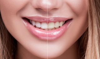 正确的牙齿增白方法 有什么方法能使牙齿增白