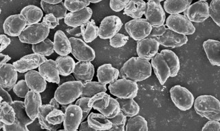 长期保存孢子可采用什么方法 孢子悬液可以保存多久