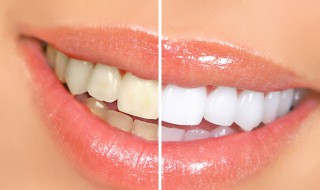 用牙线的好处和坏处 牙线会使牙缝变大吗