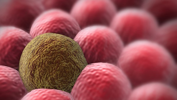 新型小细胞肺癌靶向药是什么 靶向药对小细胞癌有效果吗
