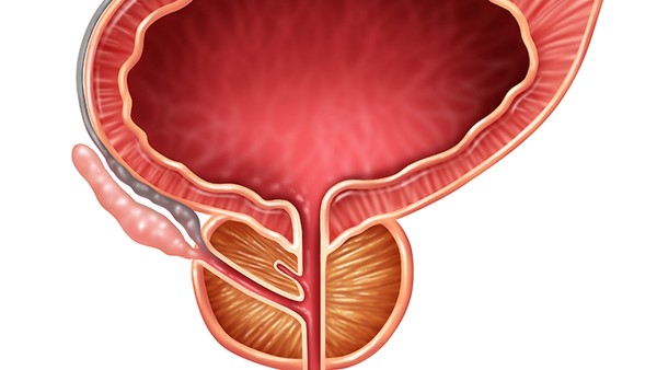 患了前列腺增生会出现哪些身体变化？