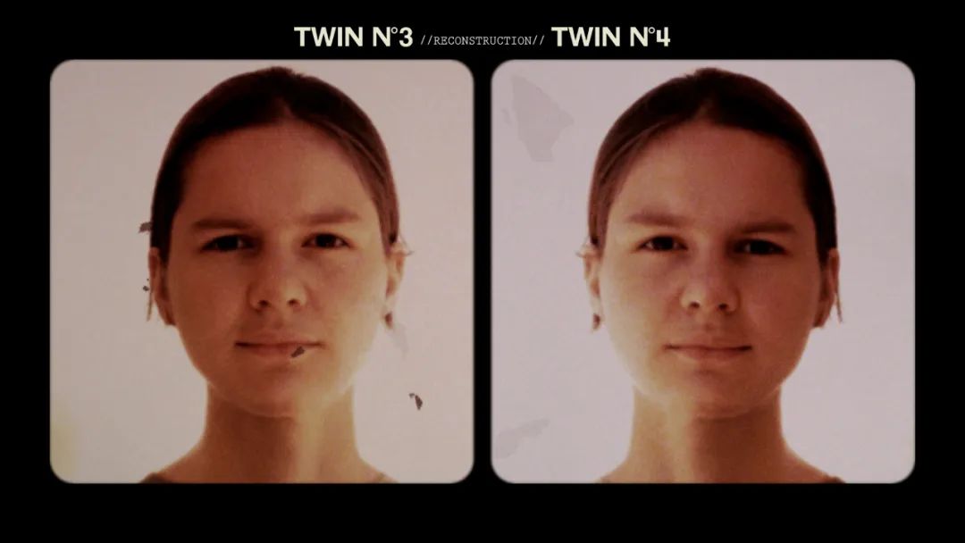 同卵双胞胎的dna一样吗