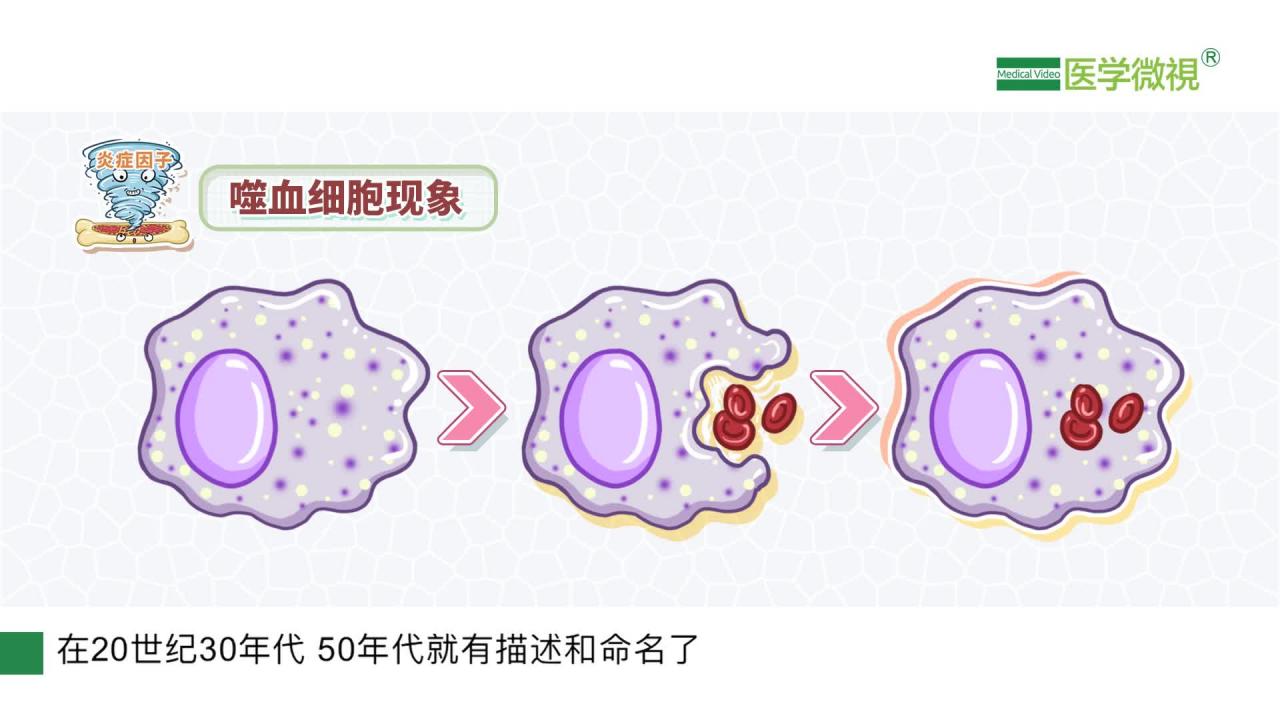 嗜血细胞综合征
