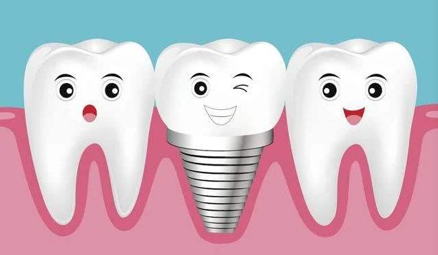 镶牙和种牙的区别