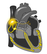 心脏holter