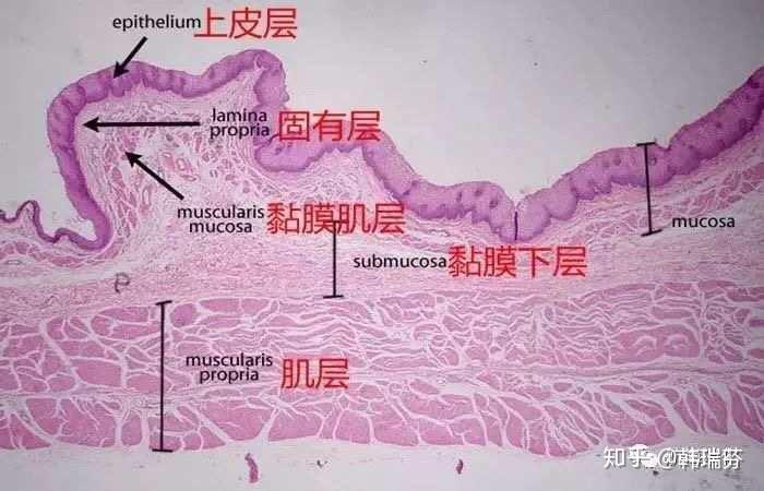 胃壁的四层结构