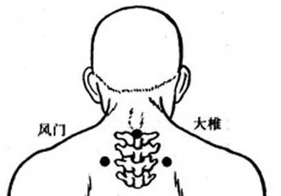 大椎的准确位置图