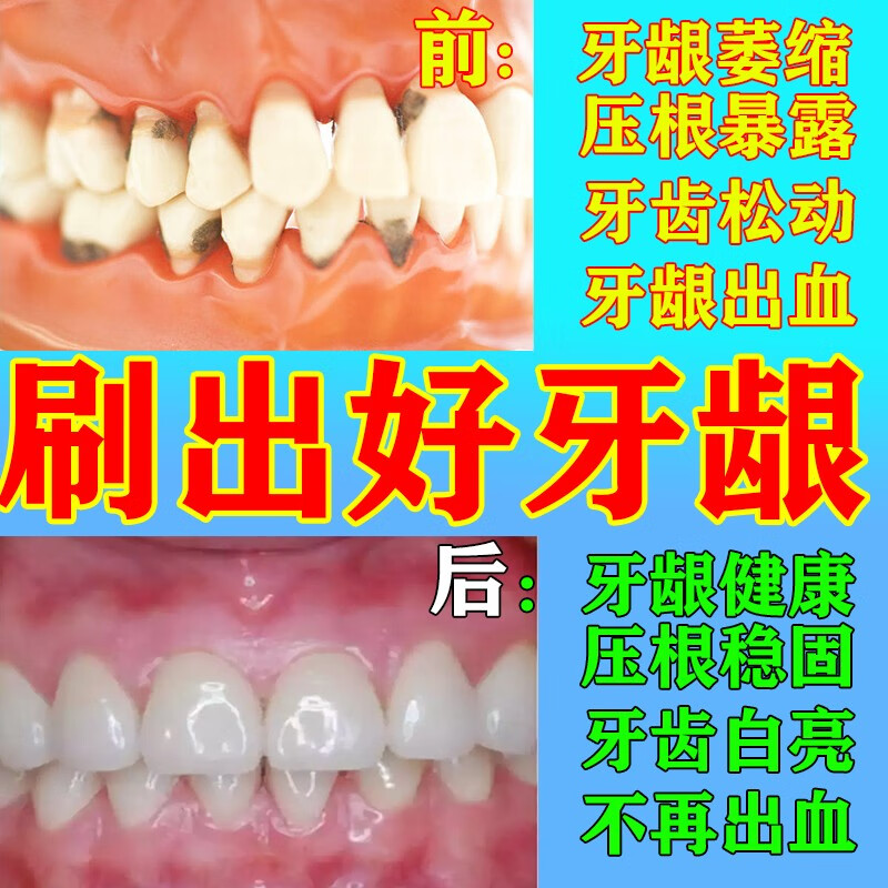 牙龈萎缩怎么调理